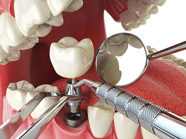 Best Emergency Root Canal Treatment in Hurley, MS